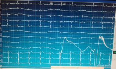 Dr. Miguel Ángel Torres (Cardiólogo, pediatra, neonatólogo, máster en hipertensión, instructor de trauma en shock).