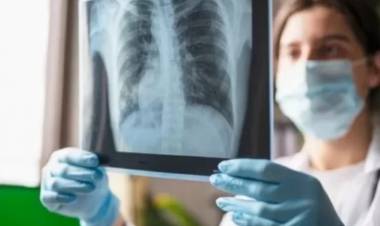 Enfermedades respiratorias: se espera el pico de casos para mitad de julio