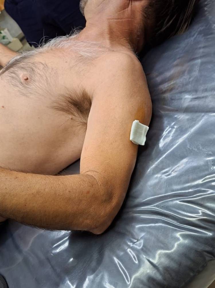 Chepes: un hombre fue herido con un arma blanca y recibió atención médica